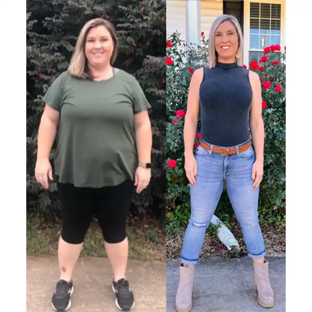 Lost over 100 lbs with Bariatric surgery!