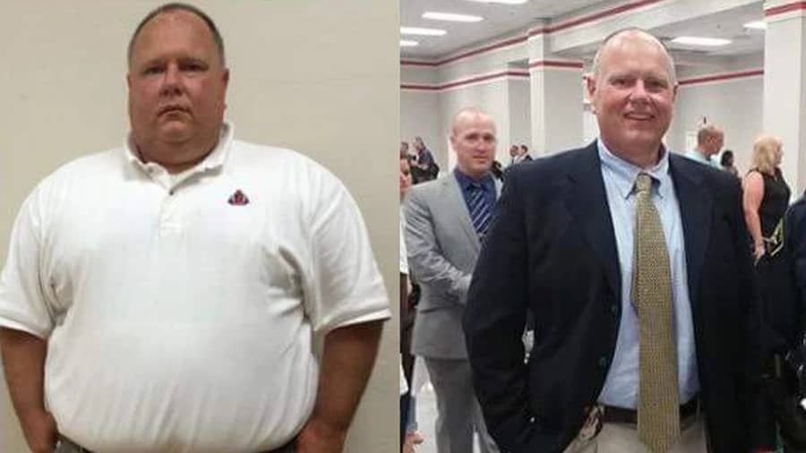 read more about kenneth hallmarks's success with alabama bariatrics