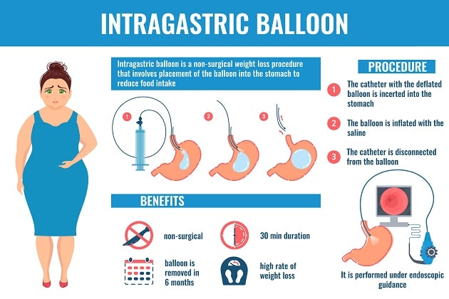 weight loss surgery without insurance