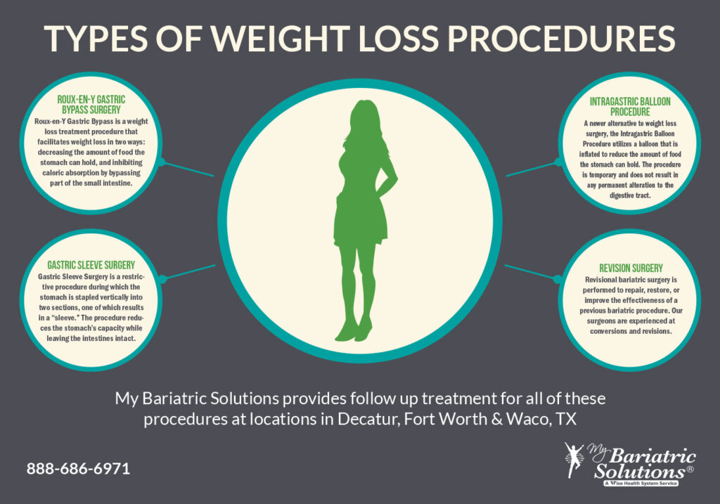 Cheapest Weight Loss Surgery at Alabama Bariatrics